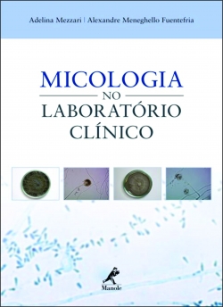Micologia no Laboratório Clínico